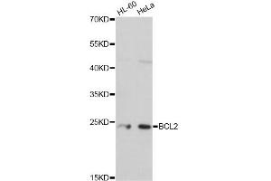 Western blot analysis of extracts of various cell lines, using BCL2 antibody. (Bcl-2 抗体)