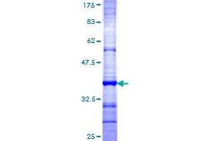 Image no. 1 for Tetraspanin 1 (TSPAN1) (AA 110-211) protein (GST tag) (ABIN1323924) (TSPAN1 Protein (AA 110-211) (GST tag))