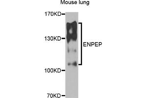Western blot analysis of extracts of mouse lung, using ENPEP antibody (ABIN5975067) at 1/1000 dilution. (ENPEP 抗体)