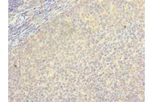 Immunohistochemistry of paraffin-embedded human tonsil tissue using ABIN7145628 at dilution of 1:100 (LOH12CR1 抗体  (AA 1-196))