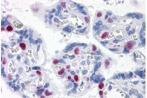 Immunohistochemistry (Formalin-fixed Paraffin-embedded Sections) (IHC (fp)) image for anti-Epithelial Stromal Interaction 1 (Breast) (EPSTI1) (AA 1-101) antibody (ABIN574468)