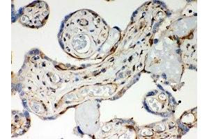 IHC-P: Optineurin antibody testing of human placenta tissue (OPTN 抗体  (AA 241-577))