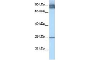 Image no. 1 for anti-Lecithin Retinol Acyltransferase (Phosphatidylcholine--Retinol O-Acyltransferase) (LRAT) (AA 51-100) antibody (ABIN6747475) (LRAT 抗体  (AA 51-100))