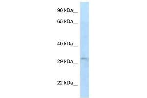 Western Blot showing TIPRL antibody used at a concentration of 1 ug/ml against 721_B Cell Lysate (TIPRL 抗体  (N-Term))