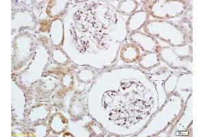 Formalin-fixed and paraffin embedded rat kidney labeled with Anti-HB EGF Polyclonal Antibody, Unconjugated  at 1:200 followed by conjugation to the secondary antibody and DAB staining (HBEGF 抗体  (AA 51-150))