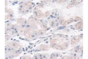 Immunohistochemistry (IHC) image for anti-Breast Cancer Anti-Estrogen Resistance 1 (BCAR1) (AA 1-240) antibody (ABIN7436351)