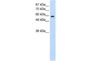 WB Suggested Anti-DAZ2 Antibody Titration:  0. (DAZ2 抗体  (N-Term))