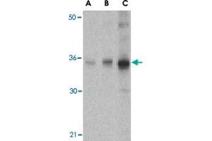 Western blot analysis of SOCS1 in human spleen tissue lysate with SOCS1 polyclonal antibody  at (A) 1, (B) 2 and (C) 4 ug/mL . (SOCS1 抗体  (N-Term))
