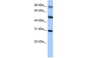 C17ORF39 antibody used at 1 ug/ml to detect target protein. (GID4 抗体  (C-Term))