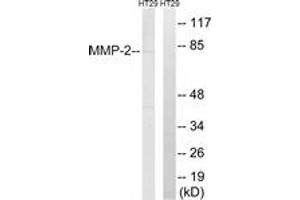 Western blot analysis of extracts from HT-29 cells, using MMP-2 Antibody. (MMP2 抗体  (AA 611-660))