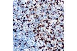 Immunohistochemical analysis of ANKRD1 staining in human lymph node formalin fixed paraffin embedded tissue section. (ANKRD1 抗体  (C-Term))