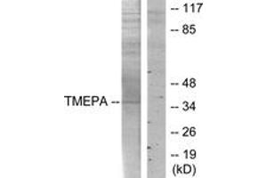 Western blot analysis of extracts from HT-29 cells, using TMEPA Antibody. (TMEPA (AA 101-150) 抗体)