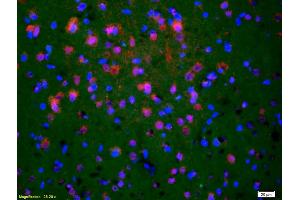 Formalin-fixed and paraffin-embedded rat brain labeled with Anti-Phospho-NMDAR2B (Tyr1252) Polyclonal Antibody, Unconjugated (ABIN801213) 1:200, overnight at 4°C, The secondary antibody was Goat Anti-Rabbit IgG, Cy3 conjugated used at 1:200 dilution for 40 minutes at 37°C.