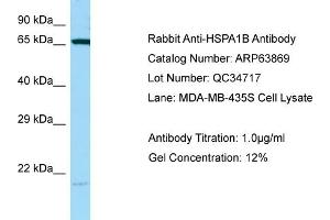 Western Blotting (WB) image for anti-Heat Shock 70kDa Protein 1B (HSPA1B) (C-Term) antibody (ABIN2789650) (HSPA1B 抗体  (C-Term))