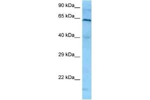 WB Suggested Anti-PLK1 Antibody   Titration: 1. (PLK1 抗体  (N-Term))
