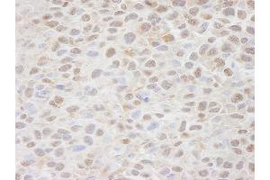Immunohistochemistry (IHC) image for anti-CSE1 Chromosome Segregation 1-Like (CSE1L) (AA 1-50) antibody (ABIN7448490) (Exportin 2 抗体  (AA 1-50))