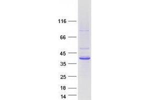 Validation with Western Blot (TMOD2 Protein (Transcript Variant 2) (Myc-DYKDDDDK Tag))