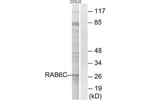 Western Blotting (WB) image for anti-RAB6C (WTH3DI) (Internal Region) antibody (ABIN1851986) (WTH3DI 抗体  (Internal Region))