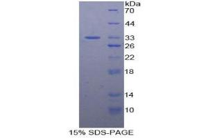 SDS-PAGE (SDS) image for N-Methylpurine-DNA Glycosylase (MPG) (AA 46-315) protein (His tag) (ABIN1879712)