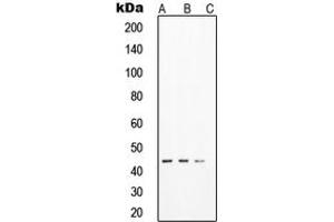 Western blot analysis of SOX17 expression in HeLa (A), LNCaP (B), DU145 (C) whole cell lysates.