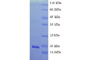 SDS-PAGE (SDS) image for Nerve Growth Factor (NGF) (AA 124-241) protein (His tag) (ABIN5713058)