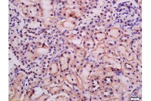 Formalin-fixed and paraffin embedded rat kidney labeled with Rabbit Anti-ATG9A Polyclonal Antibody, Unconjugated  at 1:200 followed by conjugation to the secondary antibody and DAB staining (ATG9A 抗体  (AA 301-400))