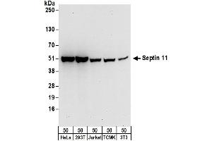 anti-Septin 11 (SEPT11) (AA 379-429) antibody