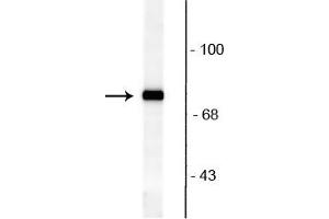 Western blot of rat brain lysate showing specific immunolabeling of the ~82 kDa rabphilin 3A phosphorylated at Ser234. (RPH3A 抗体  (pSer234))