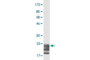Western Blot detection against Immunogen (22 KDa) . (TNFSF15 抗体  (AA 72-251))