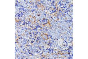Immunohistochemistry of paraffin-embedded mouse spleen using SN antibody (ABIN7270670) at dilution of 1:100 (40x lens). (SNAP23 抗体  (AA 1-211))