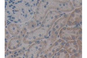 Detection of PXN in Rat Kidney Tissue using Polyclonal Antibody to Paxillin (PXN) (Paxillin 抗体  (AA 327-568))