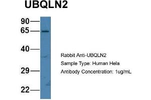 Host: Rabbit Target Name: UBQLN2 Sample Type: Hela Antibody Dilution: 1. (Ubiquilin 2 抗体  (N-Term))