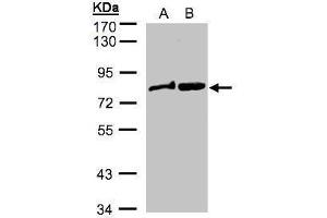 WB Image Sample(30 ug whole cell lysate) A: MOLT4 , B: Raji , 7. (DVL2 抗体  (Internal Region))