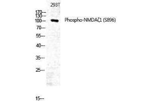 Western Blotting (WB) image for anti-Glutamate Receptor, Ionotropic, N-Methyl D-Aspartate 1 (GRIN1) (pSer896) antibody (ABIN3173254) (GRIN1/NMDAR1 抗体  (pSer896))