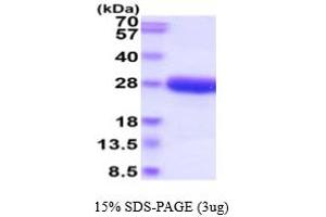 SDS-PAGE (SDS) image for Interleukin 6 (IL6) (AA 21-207) protein (His tag) (ABIN5854837)