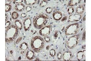 Image no. 1 for anti-TAP Binding Protein-Like (TAPBPL) antibody (ABIN1501300) (TAPBPL 抗体)