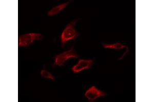 ABIN6267281 staining Hela by IF/ICC. (RAF1 抗体  (pSer259))