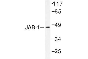 Image no. 1 for anti-COP9 Signalosome Complex Subunit 3 (COPS3) antibody (ABIN265485) (COPS3 抗体)