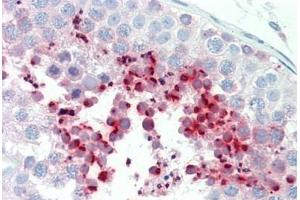 Huma Testis: Formalin-Fixed, Paraffin-Embedded (FFPE) (ADCY1 抗体  (AA 231-280))