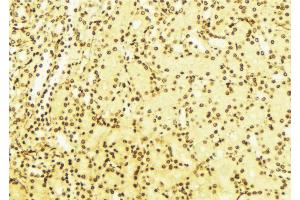 ABIN6268682 at 1/100 staining Mouse liver tissue by IHC-P. (BAG1 抗体  (N-Term))