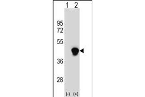 Western blot analysis of PECI (arrow) using rabbit polyclonal PECI Antibody (C-term) (ABIN652636 and ABIN2842426). (PECI/ECI2 抗体  (C-Term))