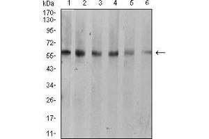 Western blot analysis using KRT10 mouse mAb against A431 (1), C6 (2), COS7 (3), Jurkat (4), NIH/3T3 (5), and HEK293 (6) cell lysate. (Keratin 10 抗体  (AA 345-454))