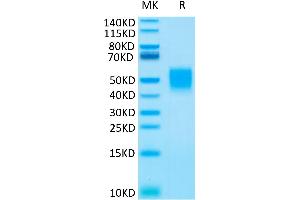 Human CD89 on Tris-Bis PAGE under reduced condition. (FCAR Protein (His tag))