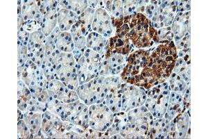 Immunohistochemical staining of paraffin-embedded liver tissue using anti-HSPA1Amouse monoclonal antibody. (HSP70 1A 抗体)