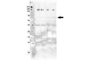 Lanes : Lane 1: Nuclear fraction from mouse substantia nigra Lane 2: Nuclear fraction from mouse substantia nigra Lane 3: Nuclear fraction from mouse cortex Lane 4: Nuclear fraction from mouse cortex Primary Antibody Dilution :  1:400   Secondary Antibody : Goat anti rabbit-HRP  Secondary Antibody Dilution :  1:10,000  Gene Name : NR4A2  Submitted by : Sorce Silvia, University of Zurich (NR4A2 抗体  (N-Term))