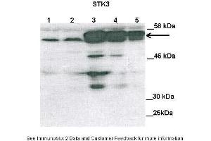 Western Blotting (WB) image for anti-serine/threonine Kinase 3 (STK3) (N-Term) antibody (ABIN2783468)