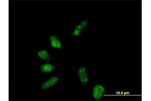 Immunofluorescence (IF) image for anti-General Transcription Factor IIB (GTF2B) (AA 1-316) antibody (ABIN516256)