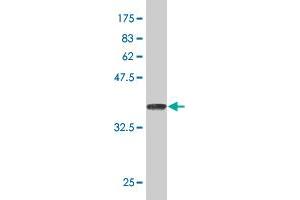 Western Blotting (WB) image for anti-Heat Shock 22kDa Protein 8 (HSPB8) (AA 97-196) antibody (ABIN565272)