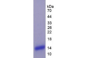 SDS-PAGE analysis of Human Plexin B1 Protein. (PLXNB1 蛋白)