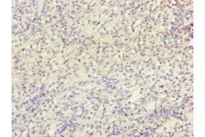 Immunohistochemistry (IHC) image for anti-NADH Dehydrogenase (Ubiquinone) 1 beta Subcomplex, 5, 16kDa (NDUFB5) (AA 100-189) antibody (ABIN7160924)